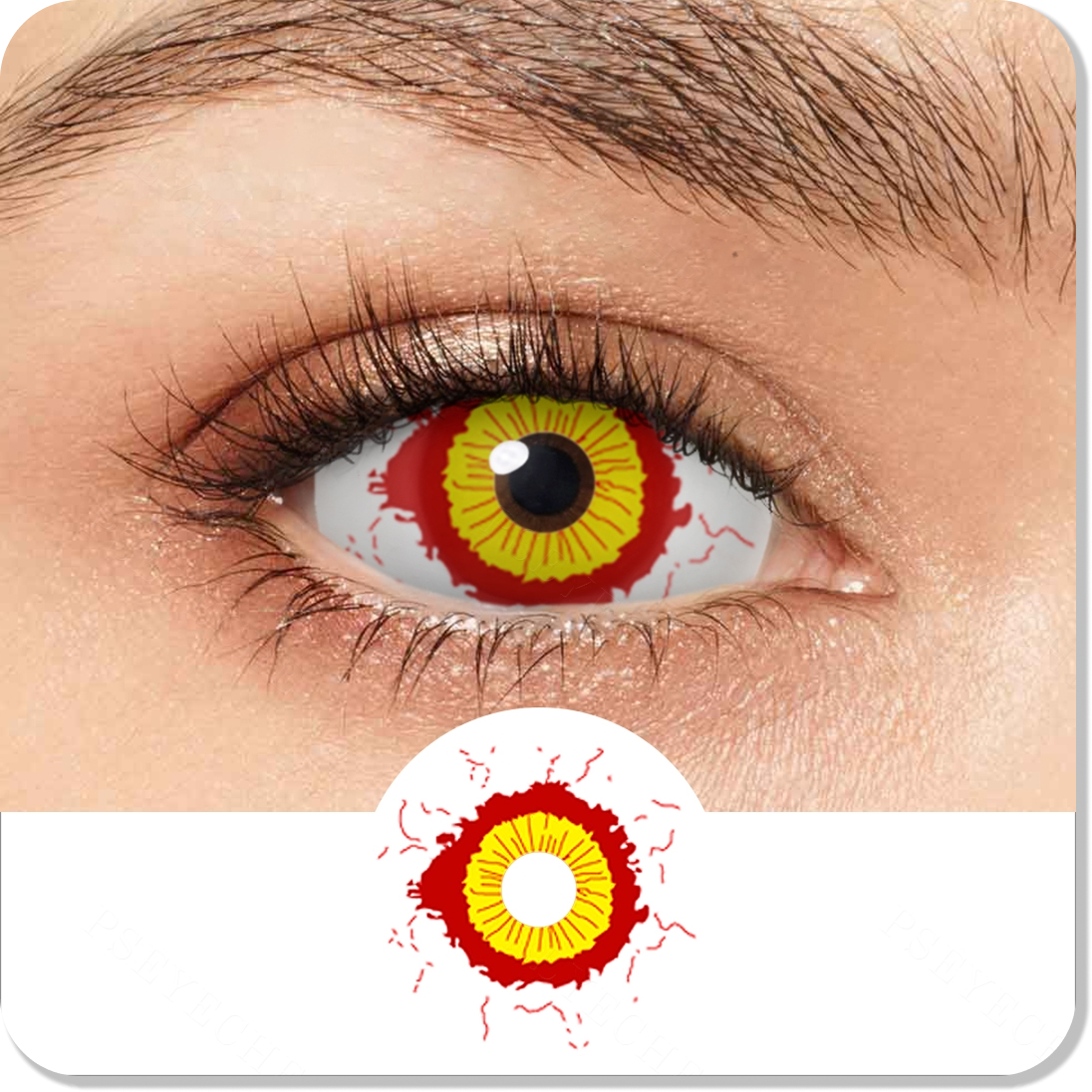 Fever Yellow And Red Sclera Eyes