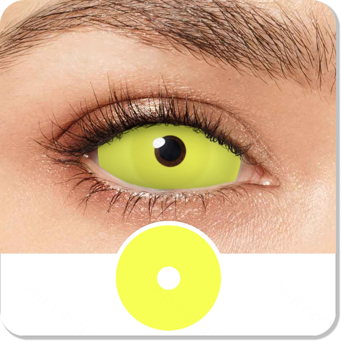 Yellow Sclera Eyes